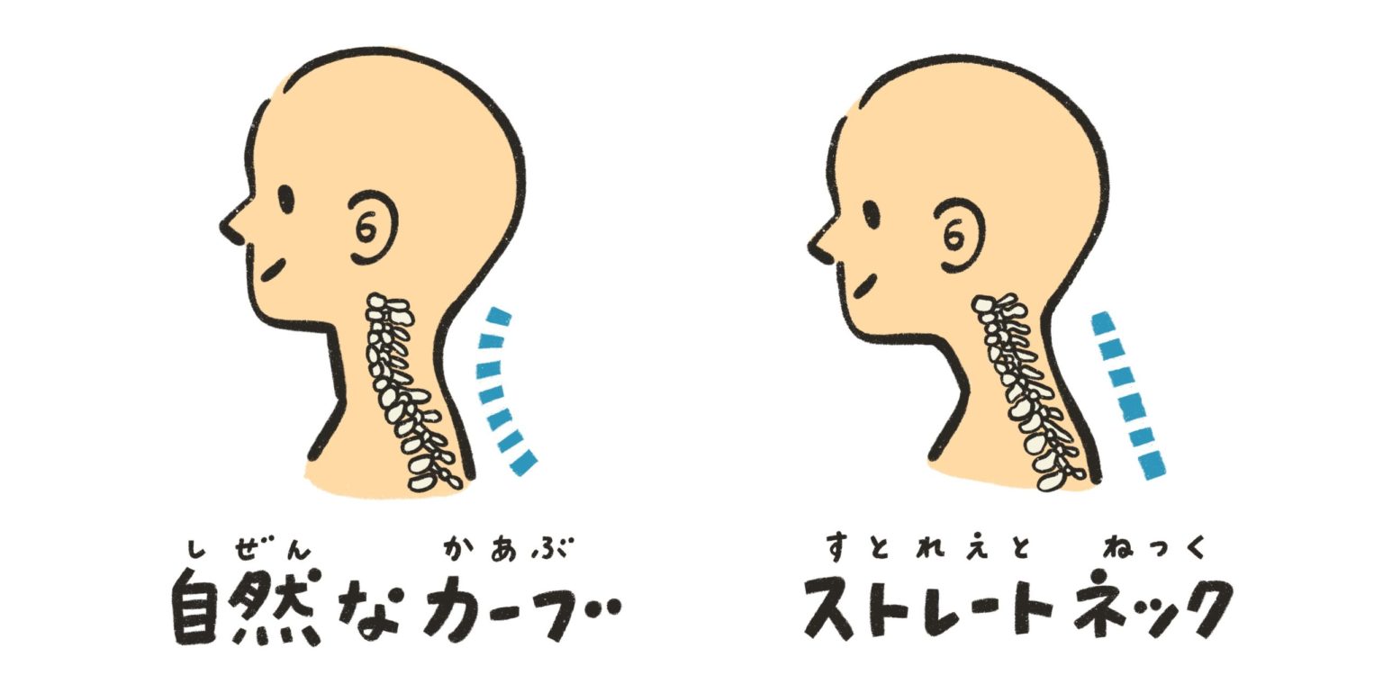 首が太いのは気のせい?もしかしたらストレートネックで首がむくんでいるのが原因かも? | 茨木市 まつお鍼灸整骨院